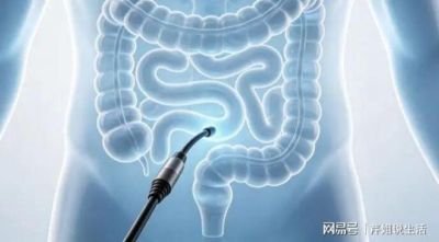非必要不做肠镜？医生：只要做过肠镜，患者一定多加关注这4点！