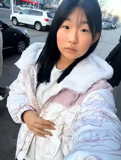 “整完容才到普通人水平!”初中女孩晒整容前后对比照,有点心酸