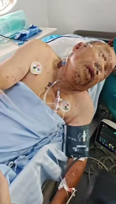 ufc直播在线观看免费视频平台