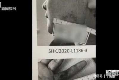 美冠杯1/8决赛首回合