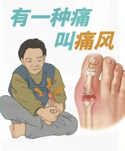 唐斯